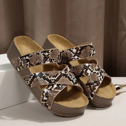 Abigail™ – Orthopedic Leather Strap Sandals